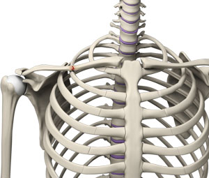 Clavicle Fractures